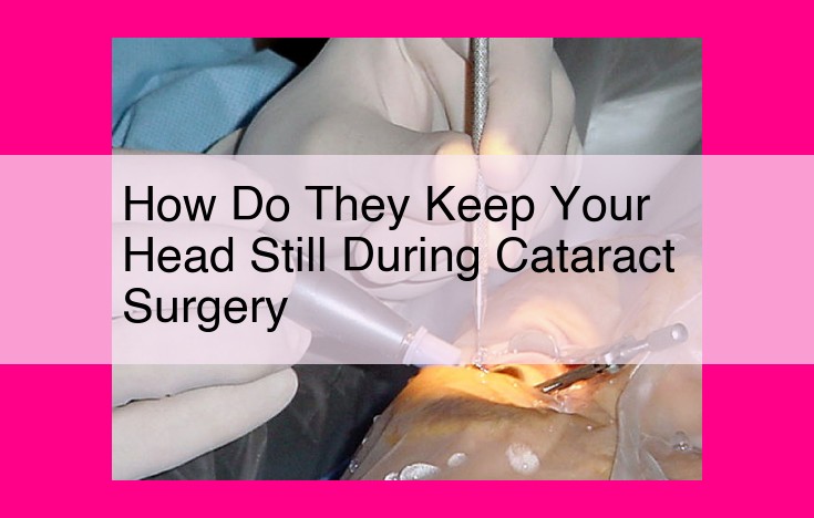 how do they keep your head still during cataract surgery