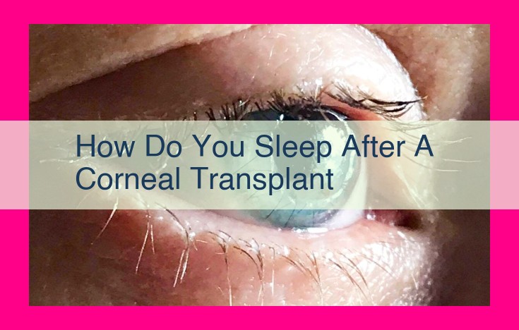 how do you sleep after a corneal transplant