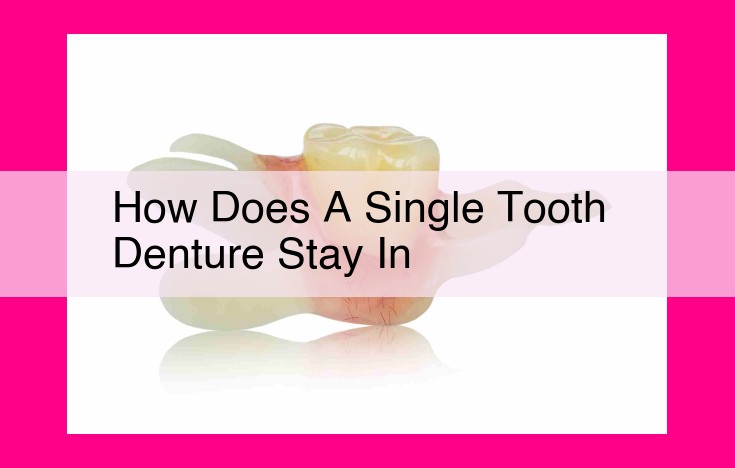 how does a single tooth denture stay in