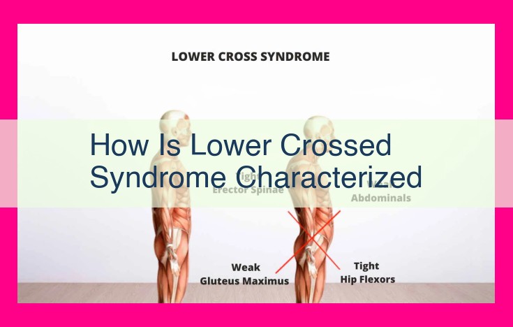 how is lower crossed syndrome characterized