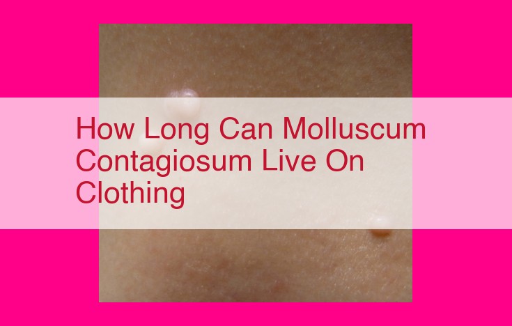 how long can molluscum contagiosum live on clothing