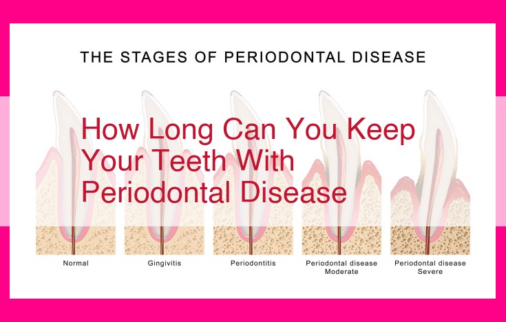 how long can you keep your teeth with periodontal disease