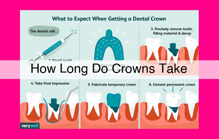 how long do crowns take