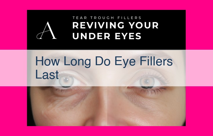 how long do eye fillers last