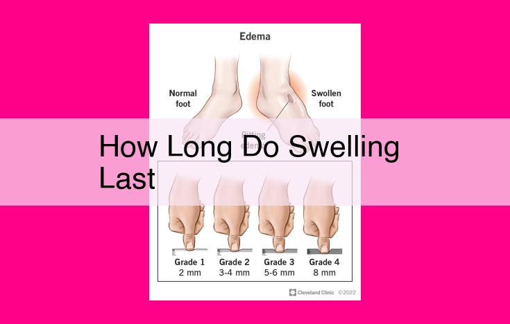 how long do swelling last