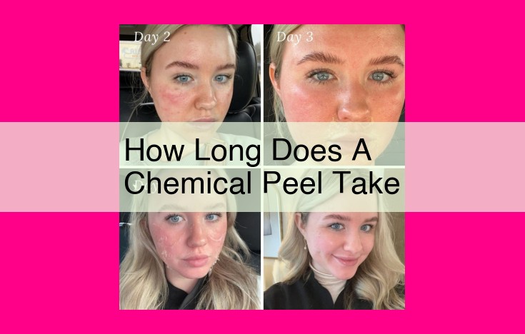 how long does a chemical peel take