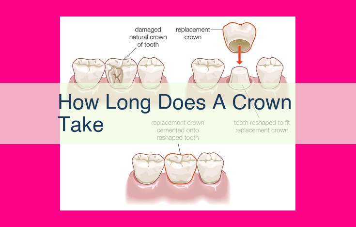 how long does a crown take