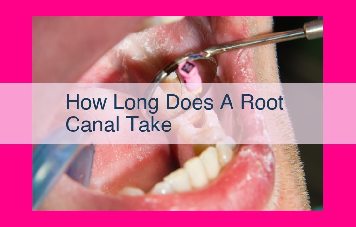 how long does a root canal take