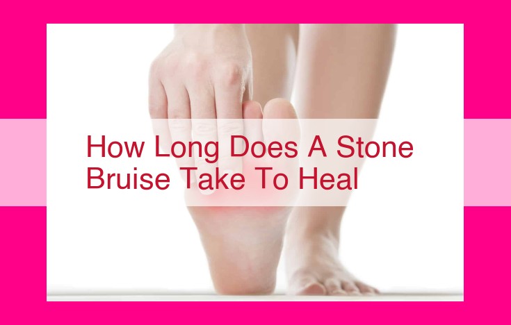 how long does a stone bruise take to heal