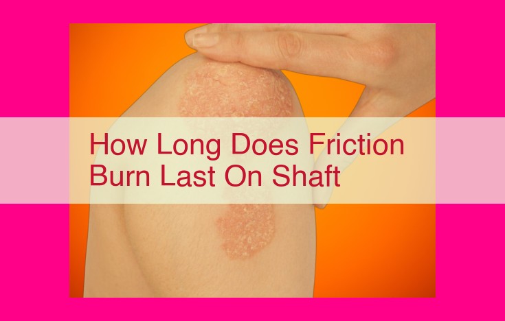 how long does friction burn last on shaft