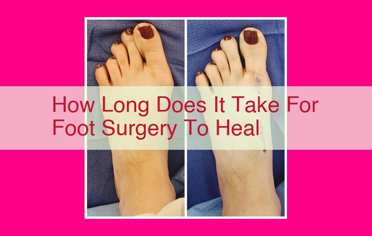 how long does it take for foot surgery to heal