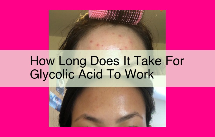 how long does it take for glycolic acid to work