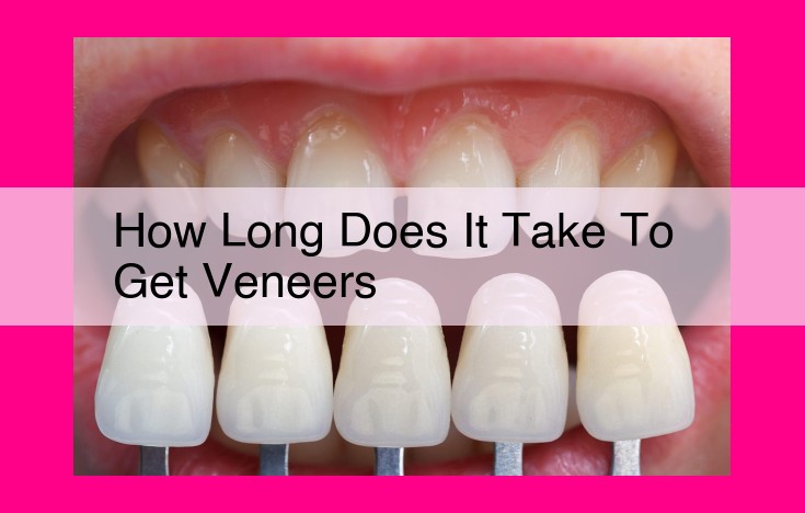 how long does it take to get veneers