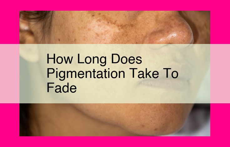 how long does pigmentation take to fade