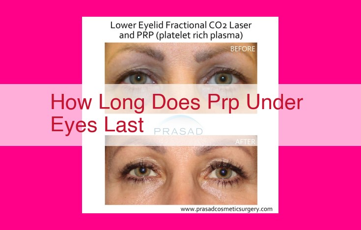 how long does prp under eyes last