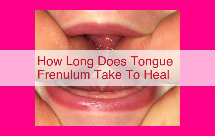 how long does tongue frenulum take to heal