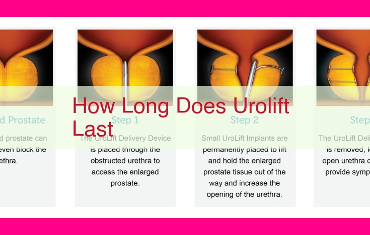 how long does urolift last