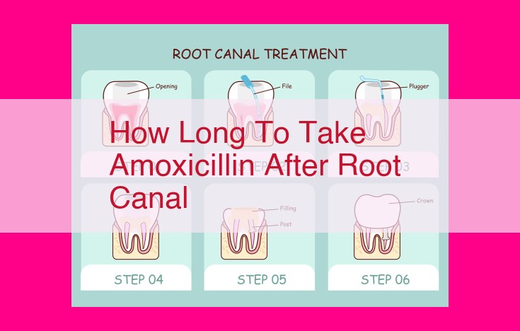 how long to take amoxicillin after root canal