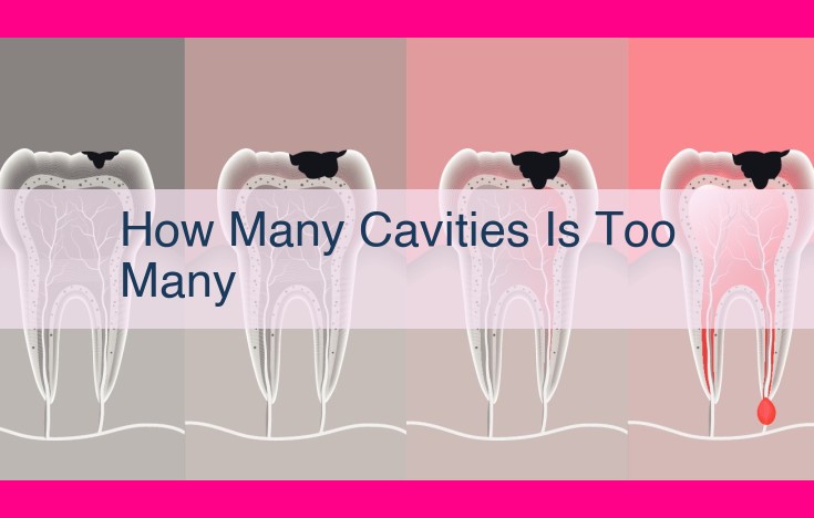 how many cavities is too many