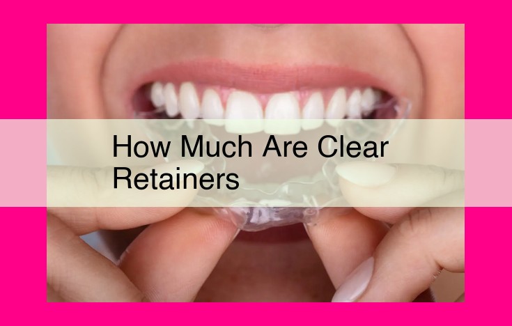 how much are clear retainers