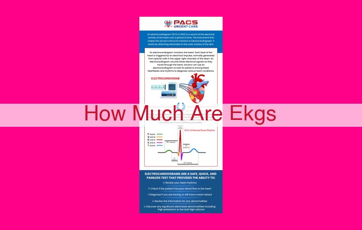 how much are ekgs