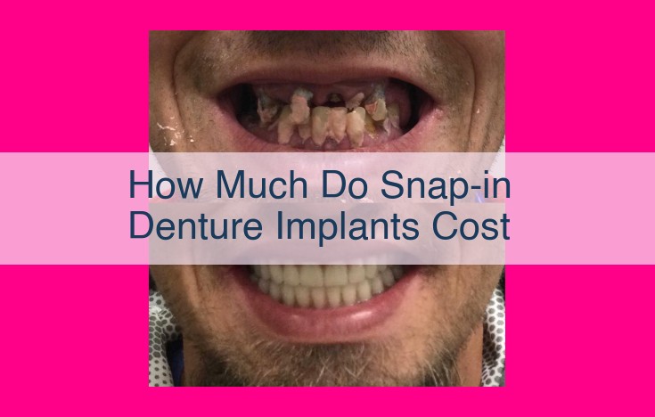 how much do snap-in denture implants cost