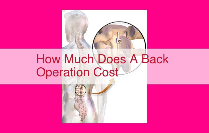 how much does a back operation cost