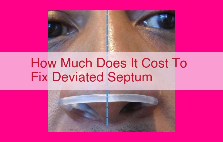 how much does it cost to fix deviated septum