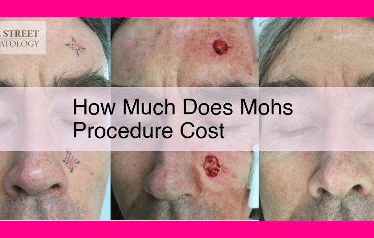 how much does mohs procedure cost