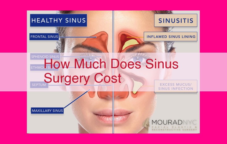 how much does sinus surgery cost