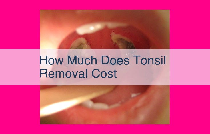 how much does tonsil removal cost