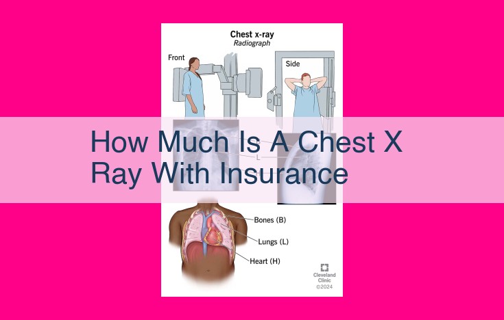 how much is a chest x ray with insurance