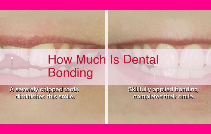 how much is dental bonding