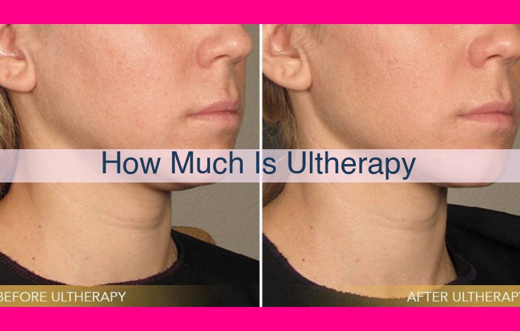 how much is ultherapy