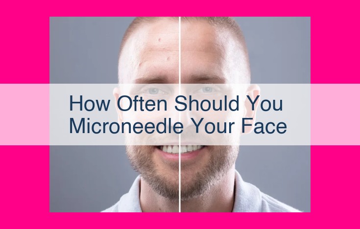 how often should you microneedle your face