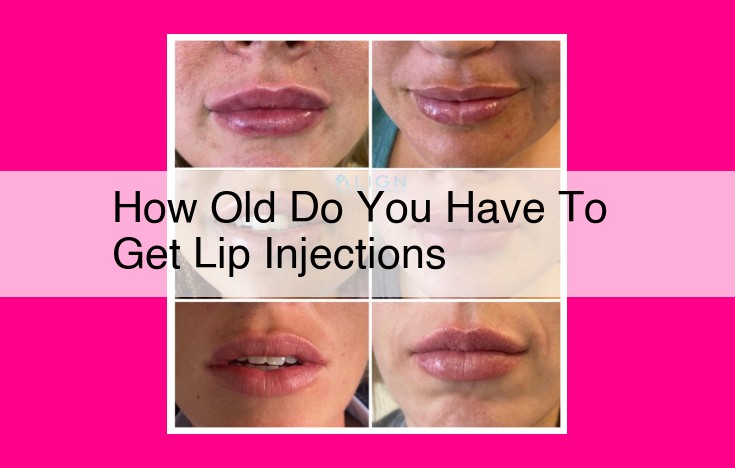 how old do you have to get lip injections