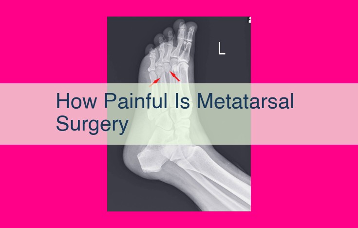 how painful is metatarsal surgery