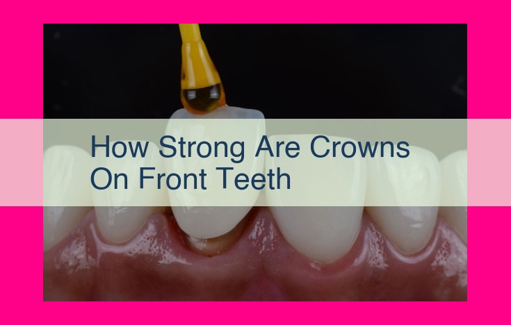 how strong are crowns on front teeth