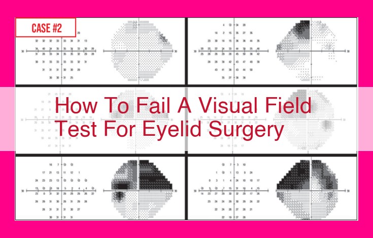 how to fail a visual field test for eyelid surgery