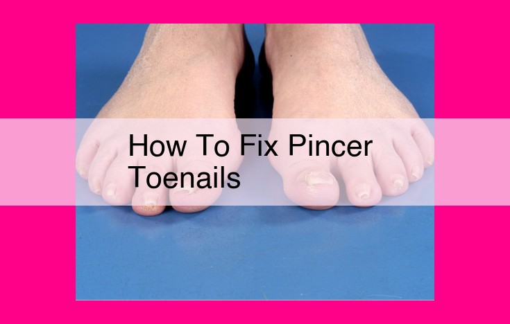 how to fix pincer toenails