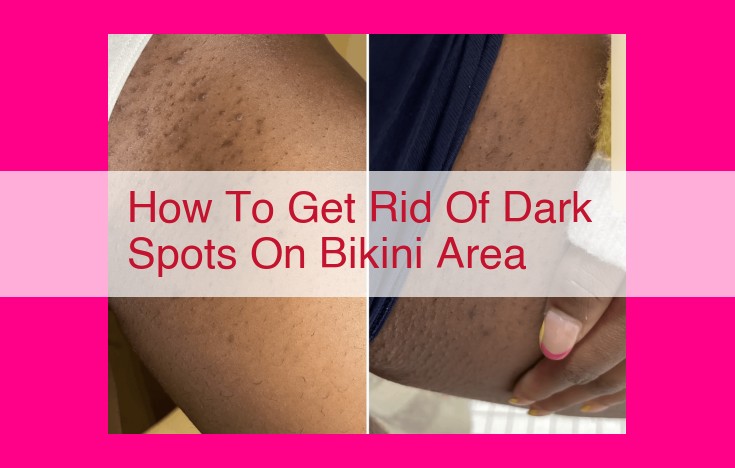 how to get rid of dark spots on bikini area