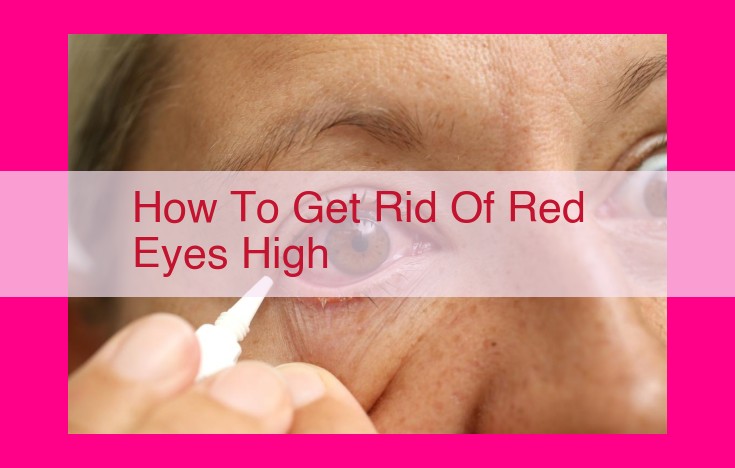 how to get rid of red eyes high