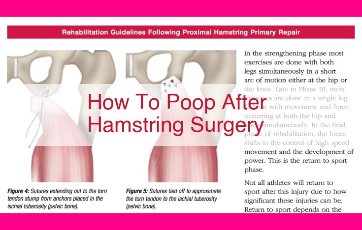 how to poop after hamstring surgery