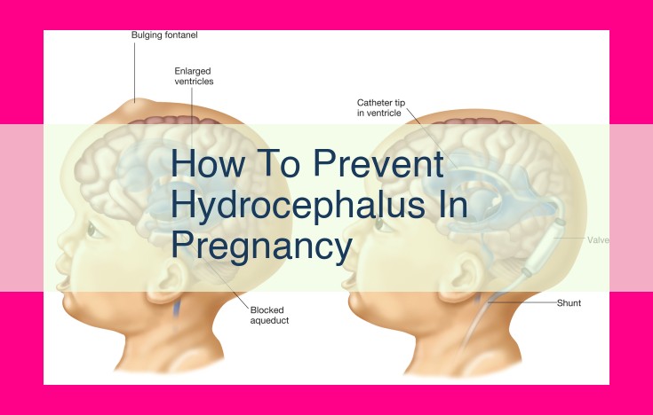 how to prevent hydrocephalus in pregnancy