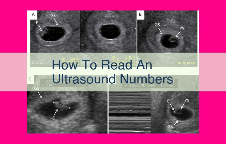 how to read an ultrasound numbers