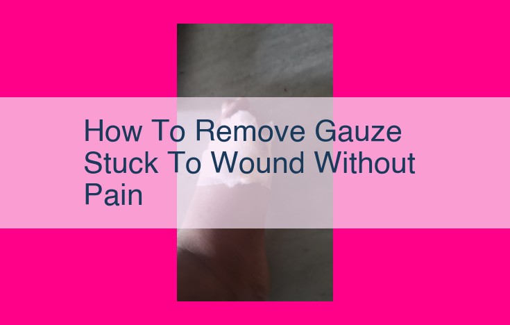 how to remove gauze stuck to wound without pain