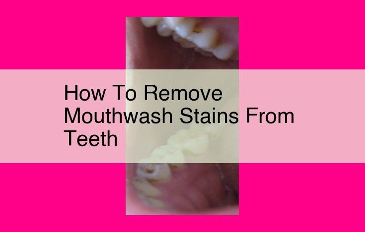 how to remove mouthwash stains from teeth