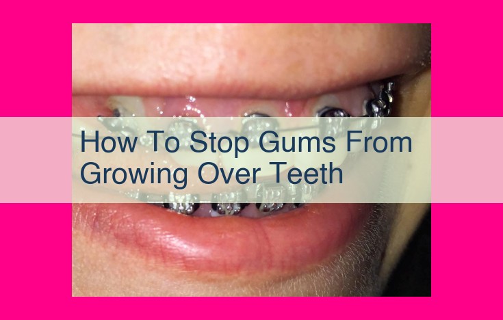 how to stop gums from growing over teeth